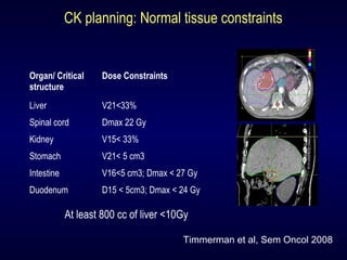 CK planning: Normal tissue constraints
Organ/ Critical
structure
Dose Constraints
Liver V21<33%
Spinal cord Dmax 22 Gy
Kid...
