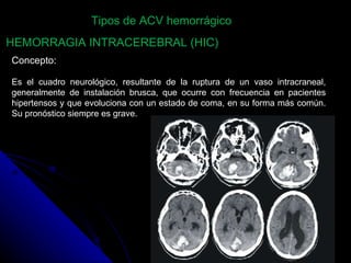 HEMORRAGIA INTRACEREBRAL (HIC)  Concepto: Es el cuadro neurológico, resultante de la ruptura de un vaso intracraneal, generalmente de instalación brusca, que ocurre con frecuencia en pacientes hipertensos y que evoluciona con un estado de coma, en su forma más común. Su pronóstico siempre es grave. Tipos de ACV hemorrágico 