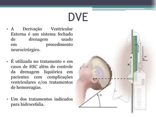 DVE, DVP, DLE E PVC | PPTX