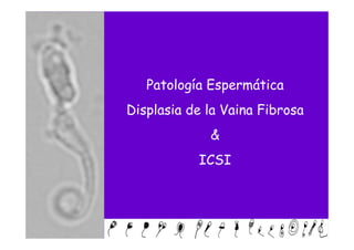 Patología Espermática
Displasia de la Vaina Fibrosa
             &
           ICSI
 