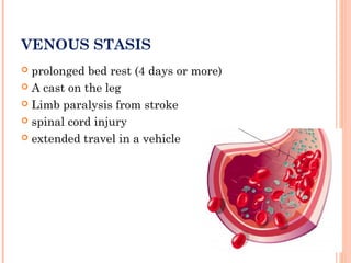 VENOUS STASIS
 prolonged bed rest (4 days or more)
 A cast on the leg

 Limb paralysis from stroke

 spinal cord injury

 extended travel in a vehicle
 