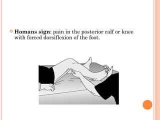    Homans sign: pain in the posterior calf or knee
    with forced dorsiflexion of the foot.
 