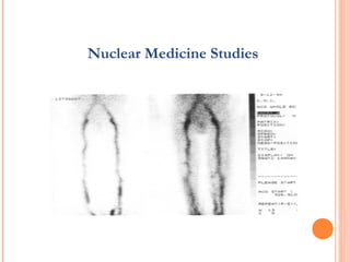 Nuclear Medicine Studies
 