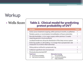 Workup 
• Wells Score 
 