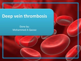 Deep vein thrombosis
Done by:
Mohammed A Qazzaz
 