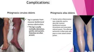 Complications:
Phlegmasia cerulea dolens Phlegmasia alba dolens
 