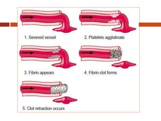 Slate Dvt Example DVT.pptx