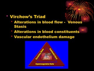 DEEP VENOUS THROMBOSIS ANESTHETIC CONSIDERATIONS | PPTX