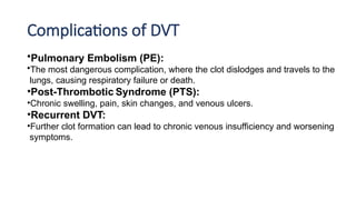 Deep vein Thrombosis - Surgery Presentation.pptx