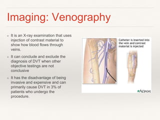 Risk Factors, Prevention, Management of DVT | PPTX
