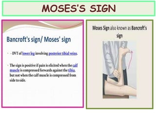 MOSES’S SIGN
 