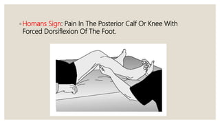 Deep Vein Thrombosis | PPTX