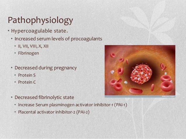 Dvt in pregnancy