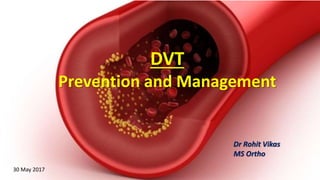 DVT
Prevention and Management
Dr Rohit Vikas
MS Ortho
30 May 2017
 
