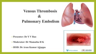 Venous Thrombosis
&
Pulmonary Embolism
• Presenter: Dr Y V Rao
• Moderator: Dr Mamatha H K
• HOD: Dr Arun Kumar Ajjappa
•
 