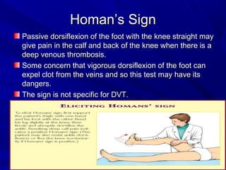 Homan’s SignHoman’s Sign
Passive dorsiflexion of the foot with the knee straight mayPassive dorsiflexion of the foot with the knee straight may
give pain in the calf and back of the knee when there is agive pain in the calf and back of the knee when there is a
deep venous thrombosis.deep venous thrombosis.
Some concern that vigorous dorsiflexion of the foot canSome concern that vigorous dorsiflexion of the foot can
expel clot from the veins and so this test may have itsexpel clot from the veins and so this test may have its
dangers.dangers.
The sign is not specific for DVT.The sign is not specific for DVT.
 