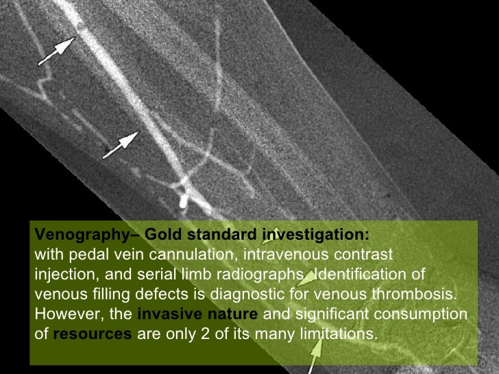 Deep venous thrombosis