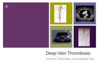 +
Deep Vein Thrombosis
Common, Preventable, and potentially Fatal
 