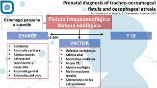 1
Prenatal diagnosis of tracheo-oesophageal
fistula and oesophageal atresia
M. Choudhry, P. A. Boyd, P. F. Chamberlain, K Lakhoo.2007
Fistula traqueoesofágica
Atresia esofágica
CHARGE T 18
VACTERL Coloboma
 Anomalía cardiaca
 Atresia coanas
 Retraso del
crecimiento y
desarrollo
 Anomalía genital
 Anomalías del oído
Estomago pequeño
o ausente
15-20%
 Defectos vertebrales
 Atresia anal
 Anomalías cardiacas
 Fistula TE
 Atresia esofágica
 Malformaciones
renales
 Alteraciones de las
extremidades
 
