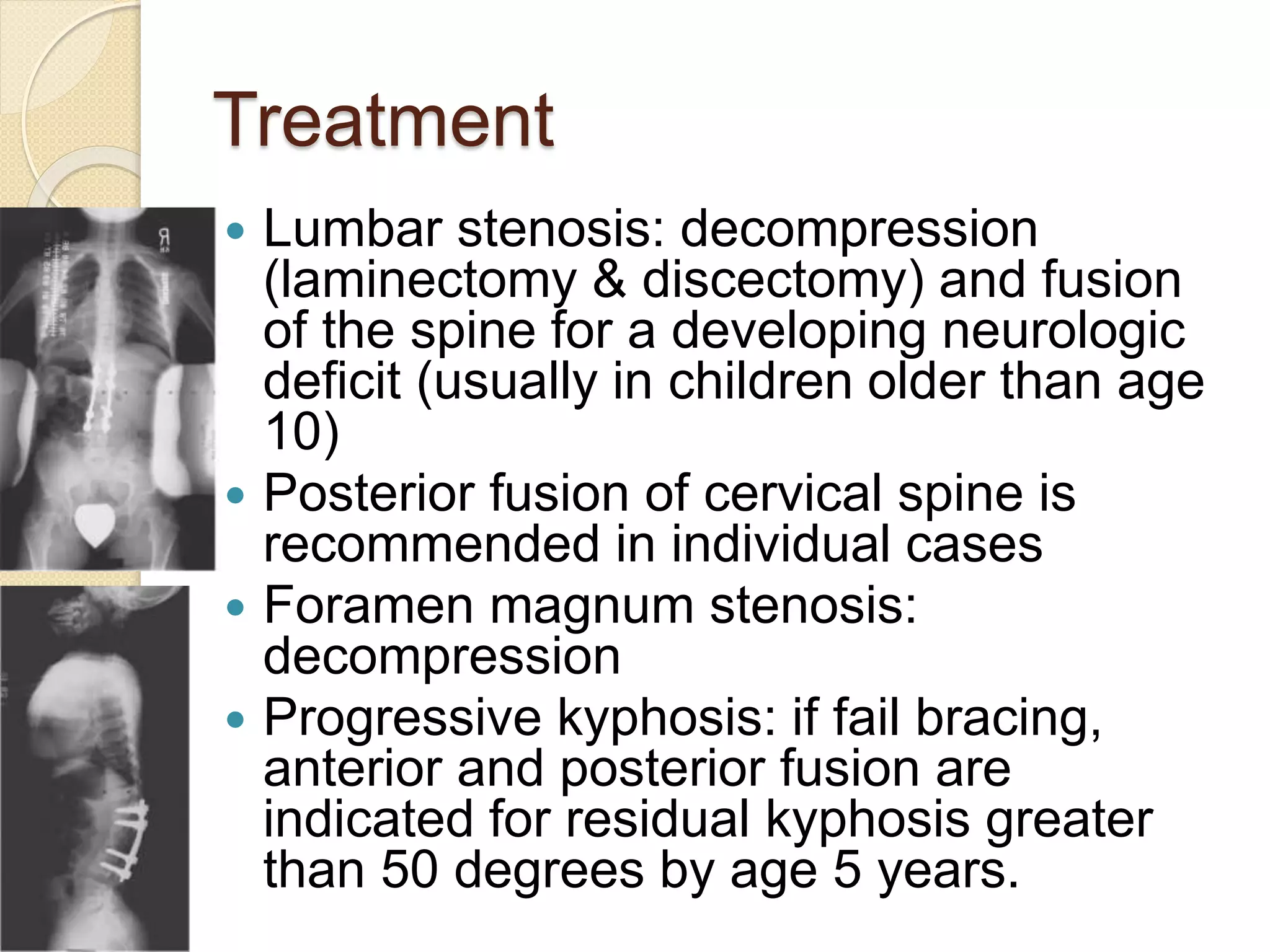 Treatment 
 Lumbar stenosis: decompression 
(laminectomy & discectomy) and fusion 
of the spine for a developing neurologic 
deficit (usually in children older than age 
10) 
 Posterior fusion of cervical spine is 
recommended in individual cases 
 Foramen magnum stenosis: 
decompression 
 Progressive kyphosis: if fail bracing, 
anterior and posterior fusion are 
indicated for residual kyphosis greater 
than 50 degrees by age 5 years. 
 