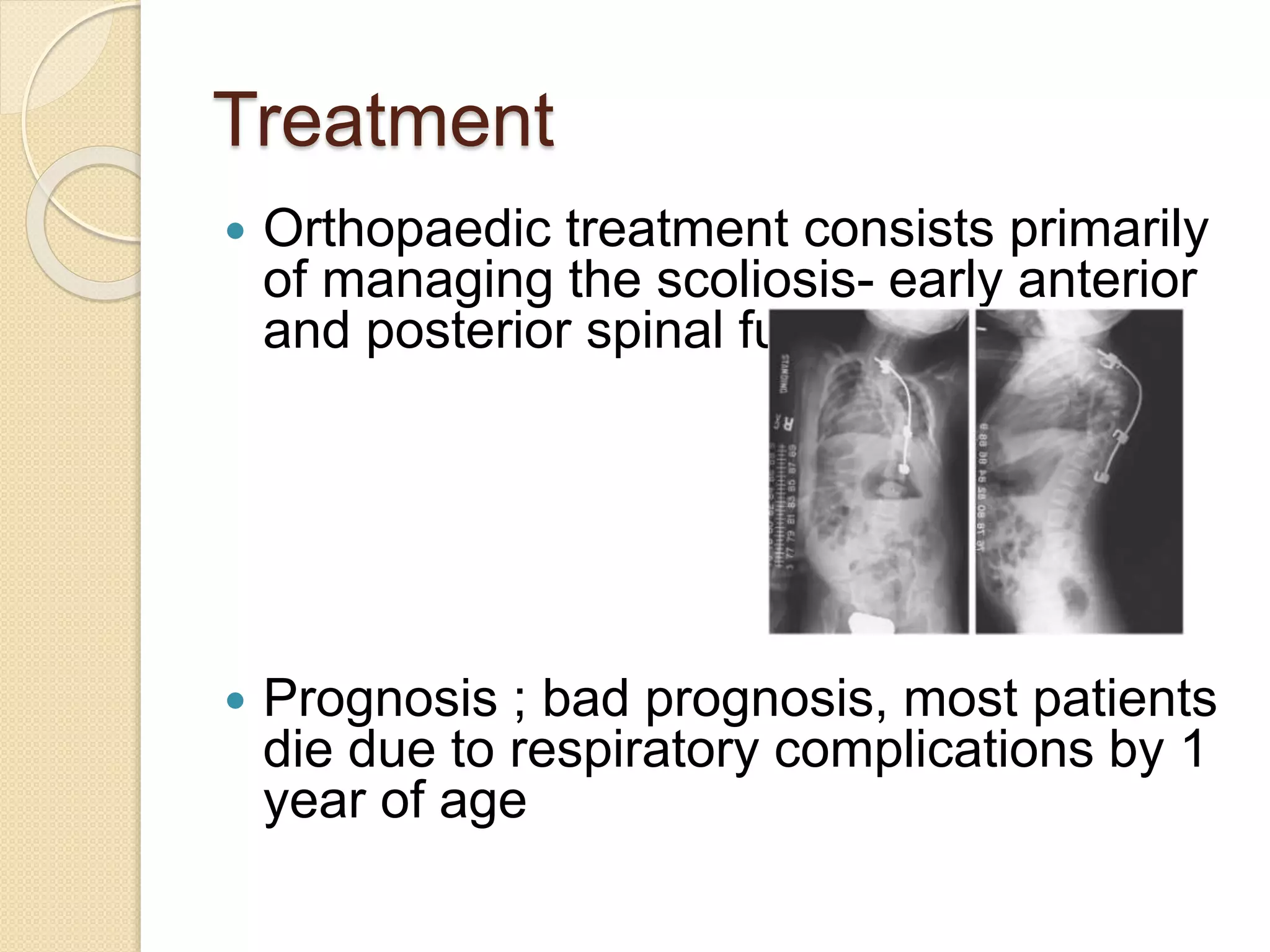 Treatment 
 Orthopaedic treatment consists primarily 
of managing the scoliosis- early anterior 
and posterior spinal fusion 
 Prognosis ; bad prognosis, most patients 
die due to respiratory complications by 1 
year of age 
 