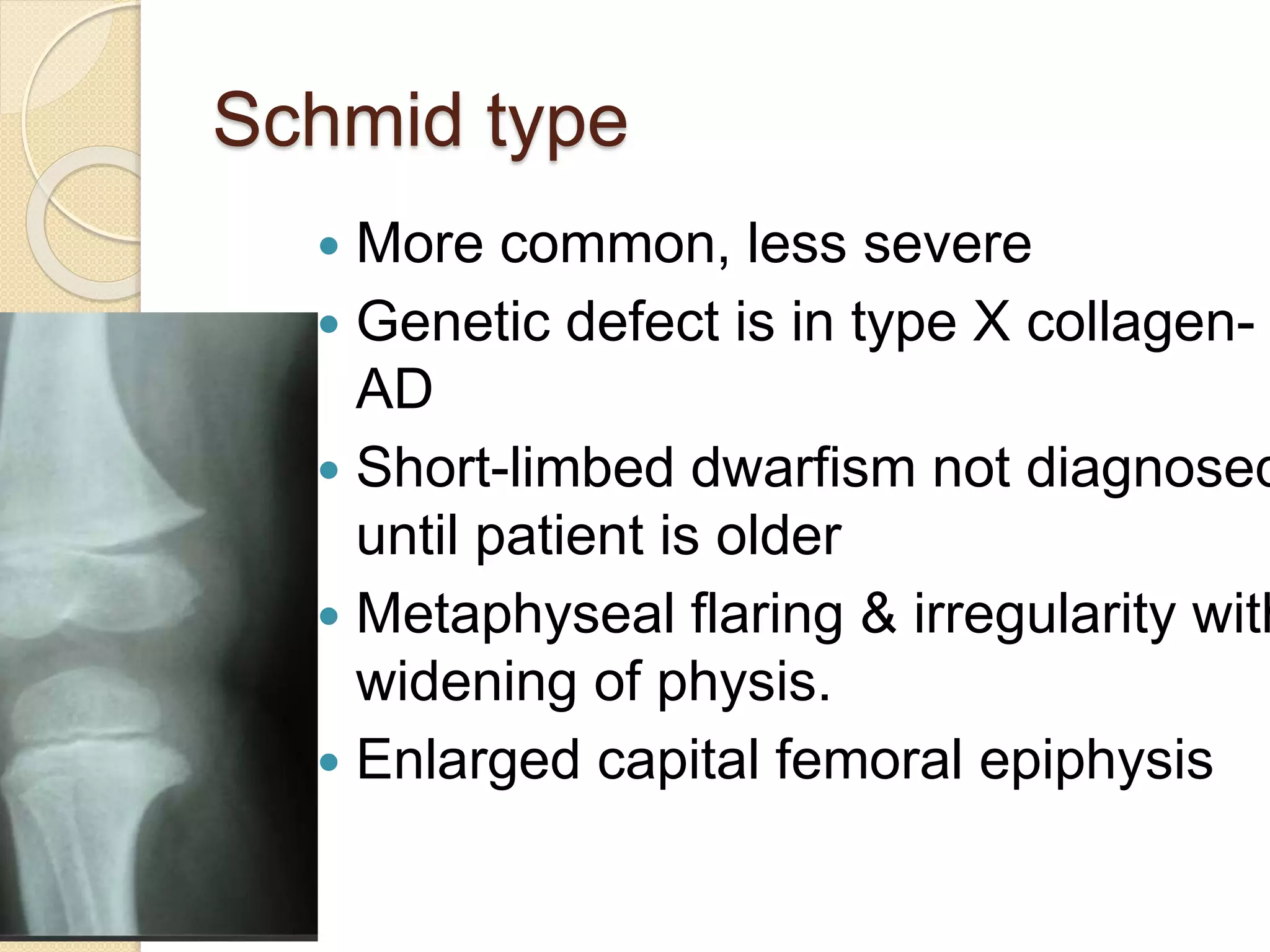Schmid type 
 More common, less severe 
 Genetic defect is in type X collagen- 
AD 
 Short-limbed dwarfism not diagnosed 
until patient is older 
 Metaphyseal flaring & irregularity with 
widening of physis. 
 Enlarged capital femoral epiphysis 
 
