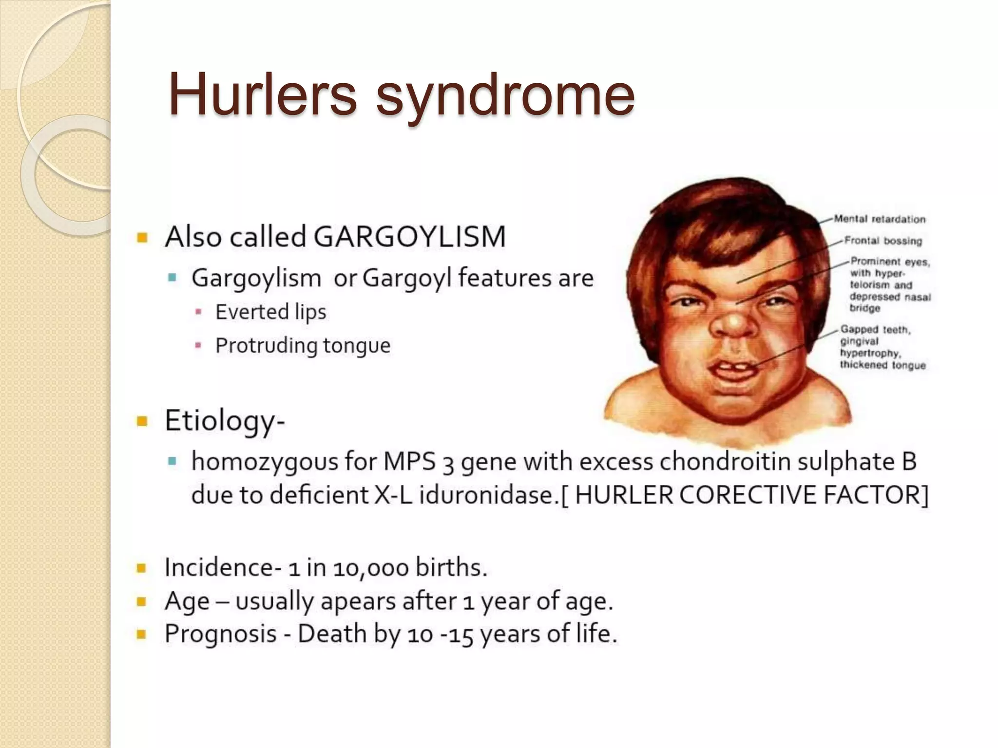Hurlers syndrome 
 