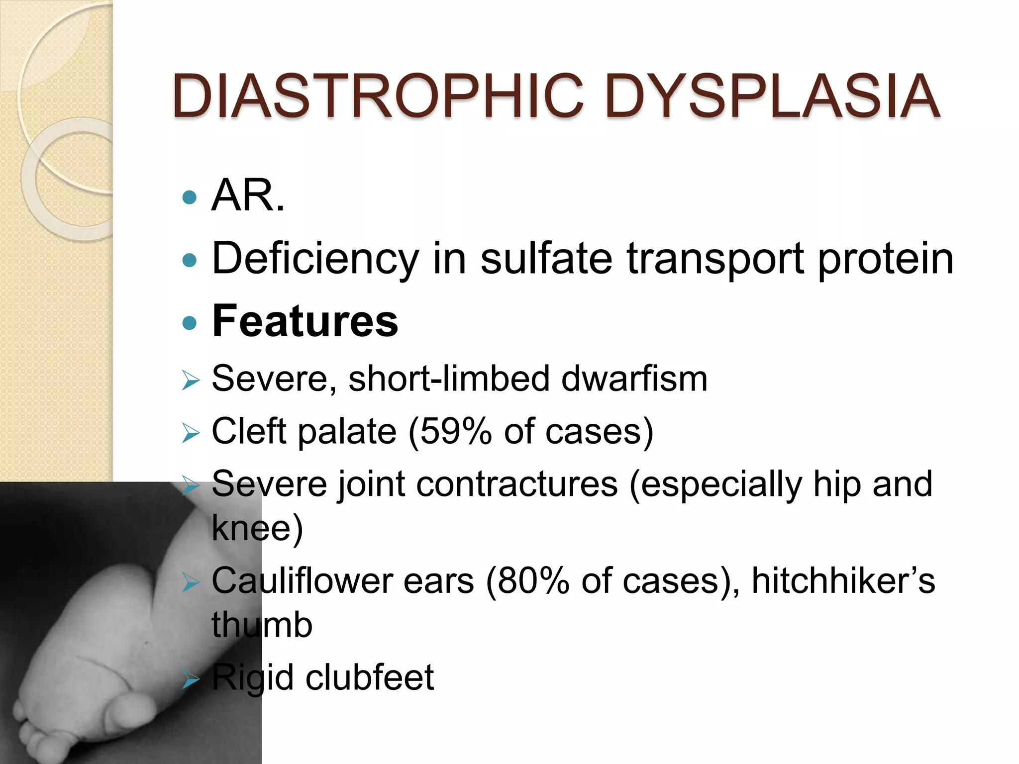 DIASTROPHIC DYSPLASIA 
 AR. 
 Deficiency in sulfate transport protein 
 Features 
 Severe, short-limbed dwarfism 
 Cleft palate (59% of cases) 
 Severe joint contractures (especially hip and 
knee) 
 Cauliflower ears (80% of cases), hitchhiker’s 
thumb 
 Rigid clubfeet 
 