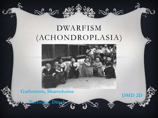 DWARFISM
      (ACHONDROPLASIA)




Gatbonton, Sharmhaine
                        DMD 2D
   Parrocha, Dinah
 