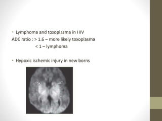 • Lymphoma and toxoplasma in HIV
ADC ratio : > 1.6 – more likely toxoplasma
< 1 – lymphoma
• Hypoxic ischemic injury in new borns
 