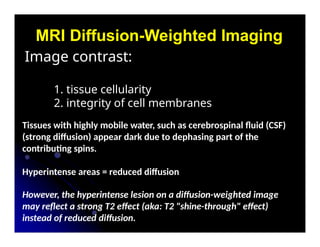 MR Diffusion weighted images is Signal b | PPTX