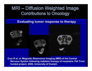 MR Diffusion weighted images is Signal b | PPTX
