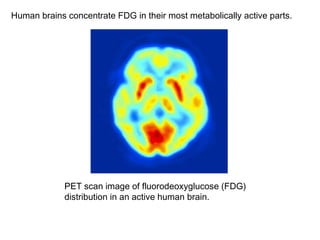 Human brains concentrate FDG in their most metabolically active parts. 
PET scan image of fluorodeoxyglucose (FDG) 
distribution in an active human brain. 
 