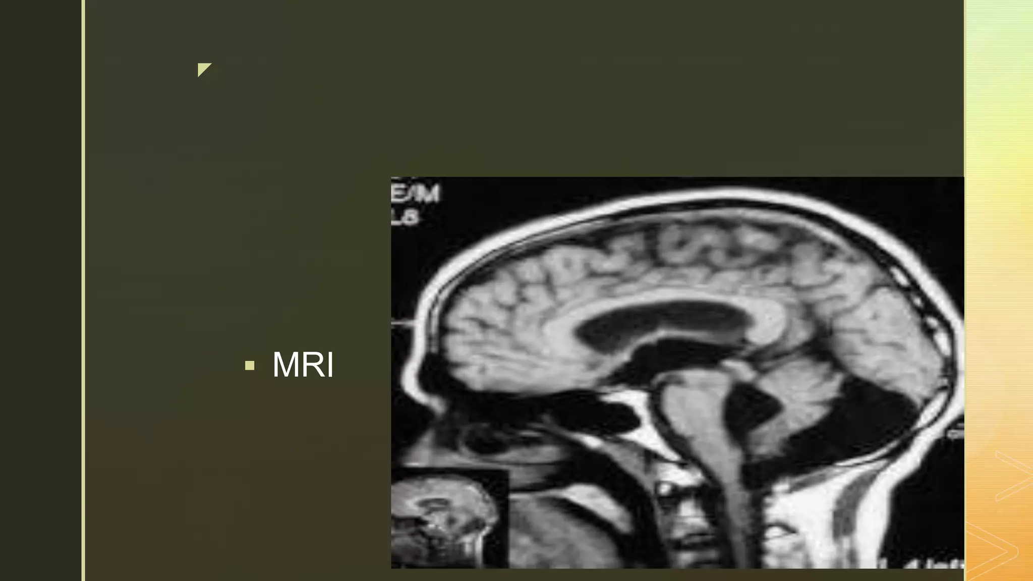 z
 MRI
 