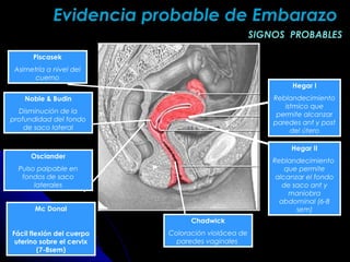 Hegar I
Reblandecimiento
istmico que
permite alcanzar
paredes ant y post
del útero
Hegar II
Reblandecimiento
que permite
alcanzar el fondo
de saco ant y
maniobra
abdominal (6-8
sem)
Chadwick
Coloración violácea de
paredes vaginales
Piscasek
Asimetría a nivel del
cuerno
Osciander
Pulso palpable en
fondos de saco
laterales
Noble & Budin
Disminución de la
profundidad del fondo
de saco lateral
SIGNOS PROBABLESSIGNOS PROBABLES
Evidencia probable de EmbarazoEvidencia probable de Embarazo
Mc Donal
Fácil flexión del cuerpo
uterino sobre el cervix
(7-8sem)
 