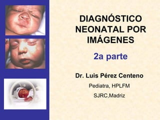 DIAGNÓSTICO NEONATAL POR IMÁGENES 2a parte Dr. Luis Pérez Centeno Pediatra, HPLFM SJRC,Madriz 
