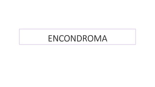 ENCONDROMA
 