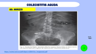 Triada Rigeler DX_COLESISTITIS criterios de tokio .pptx