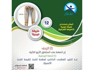 طريقة فوجيتا