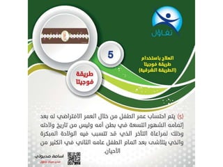 طريقة فوجيتا