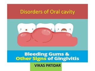 Disorders of Oral cavity
VIKAS PATIDAR
 