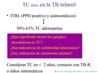 TC  tórax  en la TB infantil ITBL (PPD positivo y asintomáticos)  50%-63% TC adenopatías ¿Qué significado tienen los ganglios  descubiertos en TC? ¿Son indicativos de enfermedad tuberculosa? ¿Hay indicación de tratamiento distinto? Considerar TC en <  2 años, contacto con TB-R,  o niños sintomáticos Moreno D. Anal Esp Ped 2010; 4: 283e1-283e14 