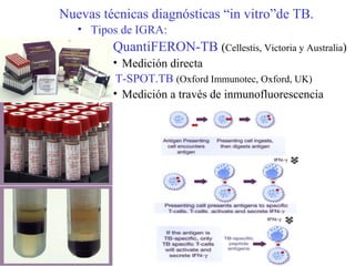 Nuevas técnicas diagnósticas “in vitro”de TB. Tipos de IGRA: QuantiFERON-TB   ( Cellestis, Victoria y Australia ) Medición directa   T-SPOT.TB   (Oxford Immunotec, Oxford, UK) Medición a través de inmunofluorescencia 