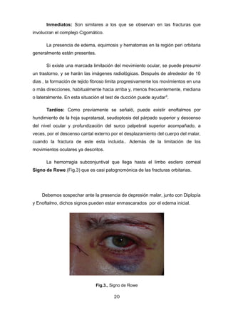 Inmediatos: Son similares a los que se observan en las fracturas que
involucran el complejo Cigomático.

      La presencia de edema, equimosis y hematomas en la región peri orbitaria
generalmente están presentes.

      Si existe una marcada limitación del movimiento ocular, se puede presumir
un trastorno, y se harán las imágenes radiológicas. Después de alrededor de 10
dias , la formación de tejido fibroso limita progresivamente los movimientos en una
o más direcciones, habitualmente hacia arriba y, menos frecuentemente, mediana
o lateralmente. En esta situación el test de ducción puede ayudar 9.

      Tardíos: Como previamente se señaló, puede existir enoftalmos por
hundimiento de la hoja supratarsal, seudoptosis del párpado superior y descenso
del nivel ocular y profundización del surco palpebral superior acompañado, a
veces, por el descenso cantal externo por el desplazamiento del cuerpo del malar,
cuando la fractura de este esta incluida.. Además de la limitación de los
movimientos oculares ya descritos.

      La hemorragia subconjuntival que llega hasta el limbo esclero corneal
Signo de Rowe (Fig.3) que es casi patognomónica de las fracturas orbitarias.




    Debemos sospechar ante la presencia de depresión malar, junto con Diplopía
y Enoftalmo, dichos signos pueden estar enmascarados por el edema inicial.




                               Fig.3., Signo de Rowe

                                        20
 
