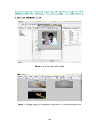 International Journal of Computer Engineering and Technology (IJCET), ISSN 0976-
6367(Print), ISSN 0976 – 6375(Online) Volume 4, Issue 3, May – June (2013), © IAEME
348
7. RESULTS AND DISCUSSION
Figure 6: Acquired Image with subplot
Figure 7: A sample output after background registration and foreground segmentation
 