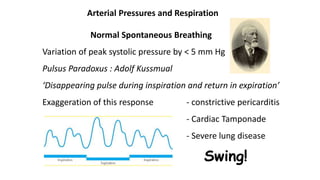 Normal Spontaneous Breathing
Variation of peak systolic pressure by < 5 mm Hg
Pulsus Paradoxus : Adolf Kussmual
‘Disappearing pulse during inspiration and return in expiration’
Exaggeration of this response - constrictive pericarditis
- Cardiac Tamponade
- Severe lung disease
Arterial Pressures and Respiration
Swing!
 