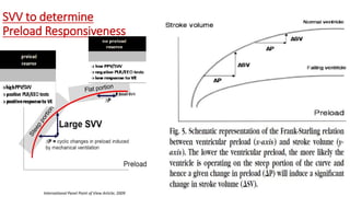 SVV to determine
Preload Responsiveness
International Panel Point of View Article; 2009
 
