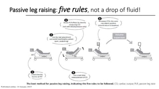Passive leg raising: five rules, not a drop of fluid!
 