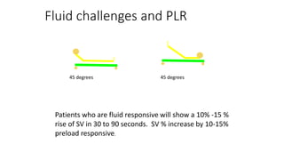 Fluid challenges and PLR
45 degrees 45 degrees
Patients who are fluid responsive will show a 10% -15 %
rise of SV in 30 to 90 seconds. SV % increase by 10-15%
preload responsive.
 