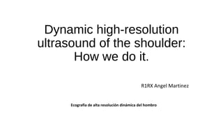 Dynamic high-resolution
ultrasound of the shoulder:
How we do it.
R1RX Angel Martinez
Ecografía de alta resolución dinámica del hombro
 